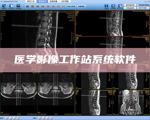 医学影像工作站系统软件