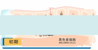 面部黄褐斑收藏美姿尔官网高效