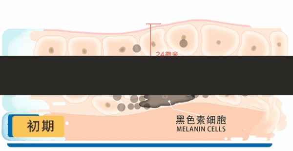 面部黄褐斑收藏美姿尔官网高效